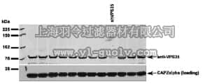 merck millipore,默克密理博,ABT48,Anti-Vesicle protein sorting 35 (VPS35) Antibody