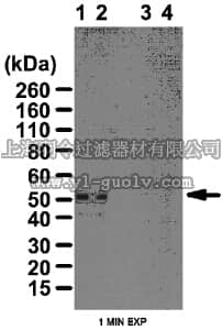merck millipore,默克密理博,ABT58,Anti-phospho PKA-RII (Ser96) Antibody