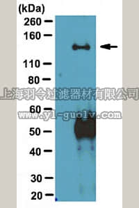 merck millipore,默克密理博,ABT70,Anti-WASH complex subunit 7 (SWIP) Antibody