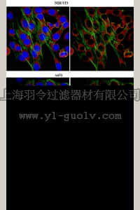 merck millipore,默克密理博,ABT79,Anti-WASH complex subunit FAM21C Antibody