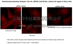 merck millipore,默克密理博,ABT80,Anti-Girdin, coiled-coil region Antibody