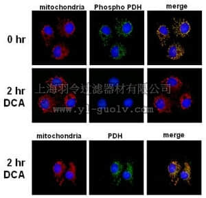 merck millipore,默克密理博,AP1062,PhosphoDetect™ Anti-PDH-E1α (pSer²⁹³) Rabbit pAb