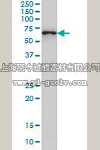 merck millipore,默克密理博,AP1135,Anti-CTNNBL1 Mouse mAb (5F1)