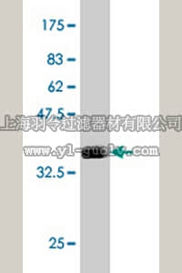 merck millipore,默克密理博,AP1139,Anti-ARSB Mouse mAb (1A4)