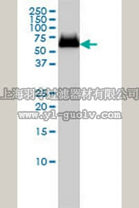 merck millipore,默克密理博,AP1140,Anti-GBA Mouse mAb (2E2)