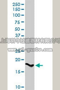 merck millipore,默克密理博,AP1142,Anti-SPINK1 Rabbit pAb