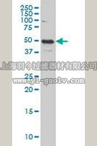 merck millipore,默克密理博,AP1145,Anti-IL13RA2 Mouse mAb (2E10)