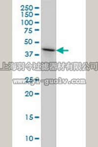 merck millipore,默克密理博,AP1162,Anti-NDRG2 Mouse mAb (6A5)
