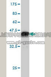 merck millipore,默克密理博,AP1170,Anti-PAFAH1B1 Mouse mAb (2C12)