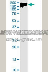 merck millipore,默克密理博,AP1174,Anti-DLC1 Rabbit pAb