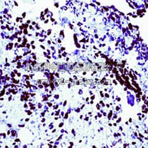 merck millipore,默克密理博,CA1026,Anti-Wilm's Tumor Protein Rabbit pAb
