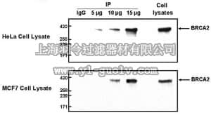 merck millipore,默克密理博,CA1033,Anti-BRCA2 Rabbit pAb