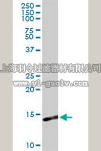 merck millipore,默克密理博,CB1022,Anti-S100A9 Rabbit pAb