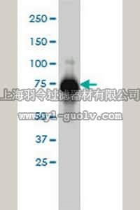 merck millipore,默克密理博,CB1025,Anti-ADD1 Mouse mAb (2C9)