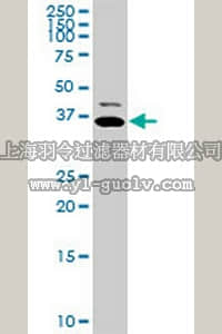 merck millipore,默克密理博,CB1027,Anti-TNNT2 Mouse mAb (3H4-F7)