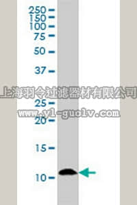 merck millipore,默克密理博,CB1036,Anti-S100A7 Mouse mAb (1A4)