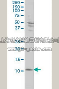merck millipore,默克密理博,CB1039,Anti-S100A4 Mouse mAb (1F12-1G7)