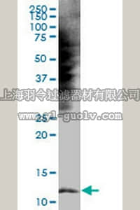 merck millipore,默克密理博,CB1040,Anti-S100B Mouse mAb (1B2) merck millipore,默克密理博,CB1040,Anti-S100B Mouse mAb (1B2)