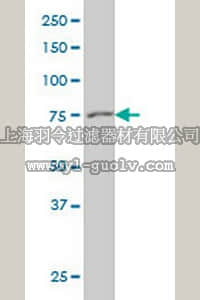 merck millipore,默克密理博,CB1042,Anti-GSN Mouse mAb (3G5)