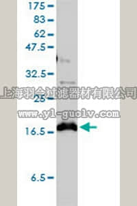 merck millipore,默克密理博,CB1046,Anti-CLDN1 Mouse mAb (1C5-D9)
