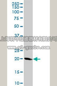 merck millipore,默克密理博,CB1047,Anti-STMN1 Rabbit pAb