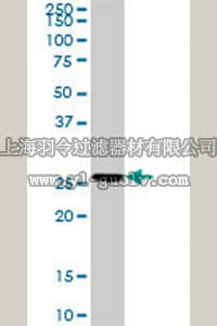 merck millipore,默克密理博,CB1048,Anti-TNNI2 Rabbit pAb