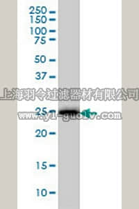 merck millipore,默克密理博,CB1050,Anti-CD99 Mouse mAb (3A10)
