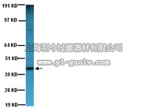 merck millipore,默克密理博,CBL171,Anti-Actin Antibody, smooth muscle, clone ASM-1