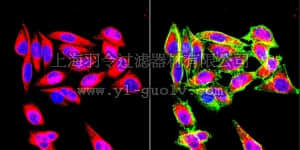 merck millipore,默克密理博,CBL202,Anti-Vimentin Antibody, clone VIM 3B4