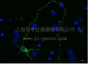 merck millipore,默克密理博,CBL412X,Anti-Tubulin β-III Antibody, clone TU-20, Alexa Fluor488 Conjugated