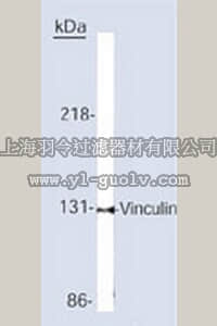 merck millipore,默克密理博,CP74,Anti-Vinculin Mouse mAb (V284 or VLN01)