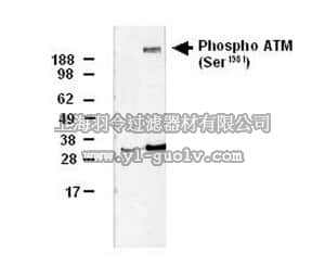 merck millipore,默克密理博,DR1002,PhosphoDetect™ Anti-ATM (pSer¹⁹⁸¹) Mouse mAb (10H11.E12)