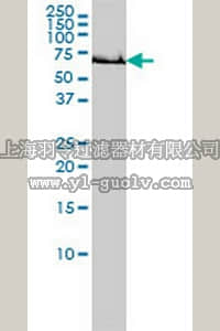 merck millipore,默克密理博,DR1045,Anti-GCLC Mouse mAb (3H1)