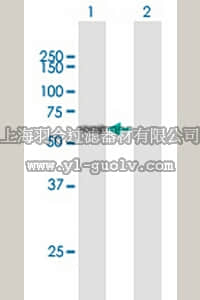 merck millipore,默克密理博,DR1056,Anti-SQSTM1 Mouse pAb