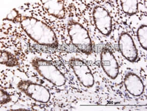 merck millipore,默克密理博,DR1058,Anti-SOCS3 Mouse mAb (1E4)
