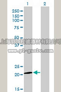 merck millipore,默克密理博,DR1086,Anti-ATF3 Mouse mAb (6B8)