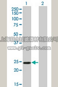merck millipore,默克密理博,DR1087,Anti-TWIST1 Mouse mAb (3E11)