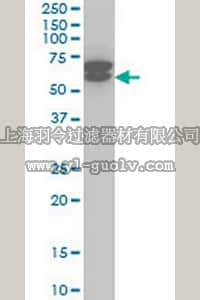 merck millipore,默克密理博,DR1093,Anti-ETV6 Mouse mAb (3B10)