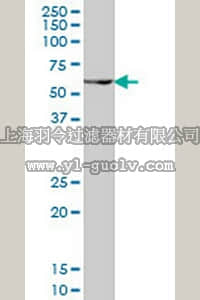 merck millipore,默克密理博,DR1094,Anti-PAX7 Mouse mAb (1E12)