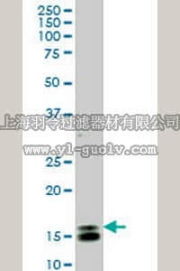 merck millipore,默克密理博,DR1098,Anti-ID1 Mouse mAb (1F7)