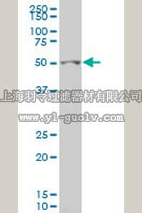 merck millipore,默克密理博,DR1123,Anti-GCM1 Mouse mAb (2E11)