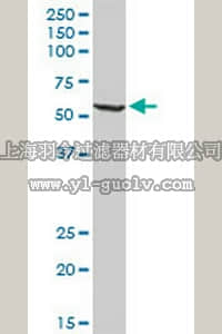 merck millipore,默克密理博,DR1125,Anti-WARS Rabbit pAb