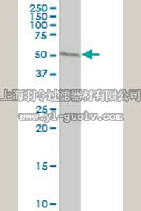 merck millipore,默克密理博,DR1126,Anti-WARS Mouse mAb (3A12)