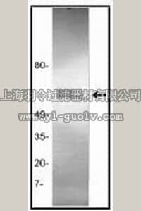 merck millipore,默克密理博,GF53,Anti-Tissue Plasminogen Activator (Ab-1) Mouse mAb (GMA-043)