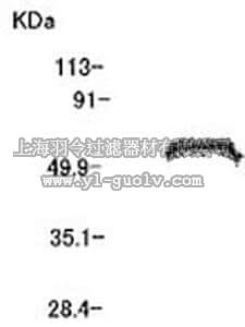 merck millipore,默克密理博,IM57,Anti-MT1-MMP (Ab-4) Mouse mAb (113-5B7)