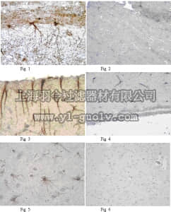 merck millipore,默克密理博,MAB10402,Anti-Plexin B1 Antibody, clone 19A7.1