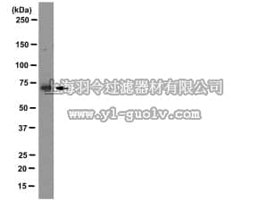 merck millipore,默克密理博,MAB10750,Anti-LIMK1 Antibody, clone 40/00-1B11-1-1