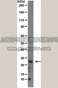 merck millipore,默克密理博,MAB10762,Anti-Transthyretin Antibody, clone 7G8-E11-E7