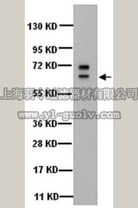 merck millipore,默克密理博,MAB1620,Anti-Cytokeratin 5 Antibody, 6, clone D5/16B4
