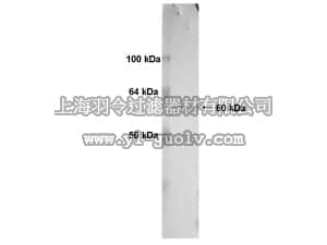 merck millipore,默克密理博,MAB1767,Anti-Human MT1-MMP catalytic domain Antibody, clone 3G4.2